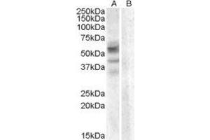 ABIN2561230 (0. (Arylsulfatase D anticorps  (Internal Region))