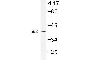 Image no. 1 for anti-Tumor Protein P53 (TP53) antibody (ABIN272156) (p53 anticorps)