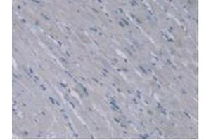 Detection of AGXT2 in Rat Heart Tissue using Polyclonal Antibody to Alanine Glyoxylate Aminotransferase 2 (AGXT2)