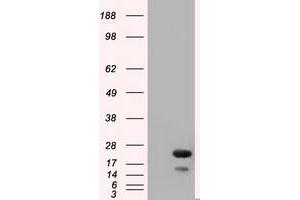 Western Blotting (WB) image for anti-RAB17, Member RAS Oncogene Family (RAB17) antibody (ABIN1500538) (RAB17 anticorps)
