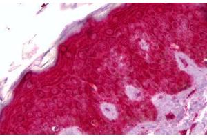 Anti-GPNMB antibody IHC staining of human skin. (Osteoactivin anticorps  (AA 1-572))