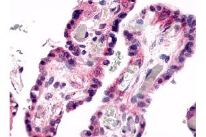 Immunohistochemical staining of Placenta (Villi) using anti- GPR78 antibody ABIN122184 (GPR78 anticorps)