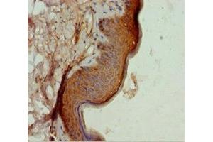 Immunohistochemistry of paraffin-embedded human skin tissue using ABIN7172703 at dilution of 1:100