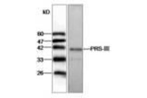Image no. 1 for anti-phosphoribosyl Pyrophosphate Synthetase 1-Like 1 (PRPS1L1) antibody (ABIN791432) (PRPS1L1 anticorps)