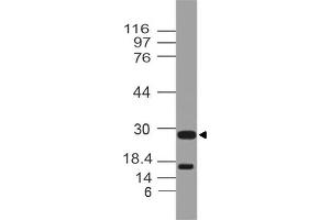 Image no. 1 for anti-Cytokine Receptor-Like Factor 2 (CRLF2) (AA 102-310) antibody (ABIN5027603) (CRLF2 anticorps  (AA 102-310))