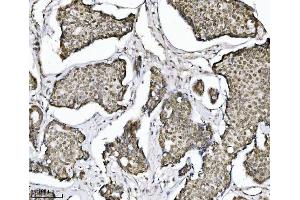 anti-Tripartite Motif Containing 24 (TRIM24) (AA 706-964) antibody