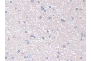 Detection of ARPC2 in Human Cerebrum Tissue using Polyclonal Antibody to Actin Related Protein 2/3 Complex Subunit 2 (ARPC2)