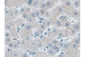 Detection of VCP in Human Liver Tissue using Polyclonal Antibody to Valosin Containing Protein (VCP)