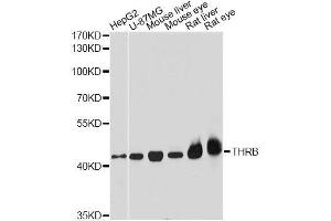 Western blot analysis of extracts of various cell lines, using THRB antibody.