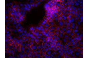Immunofluorescence (IF) image for anti-Epithelial Cell Adhesion Molecule (EPCAM) antibody (Alexa Fluor 647) (ABIN2657756)