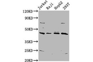 Western Blot Positive WB detected in: Jurkat whole cell lysate, Raji whole cell lysate, HepG2 whole cell lysate, 293T whole cell lysate All lanes: SPO11 antibody at 5. (SPO11 anticorps  (AA 28-109))