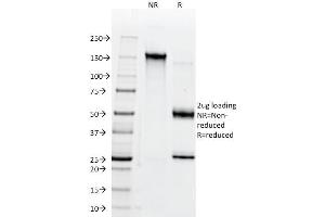 SDS-PAGE Analysis Purified CD147 Mouse Monoclonal Antibody (BSG/963).