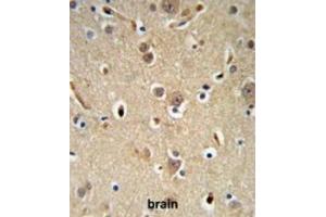 Immunohistochemistry (IHC) image for anti-Neural Precursor Cell Expressed, Developmentally Down-Regulated 4, E3 Ubiquitin Protein Ligase (NEDD4) antibody (ABIN2971025)