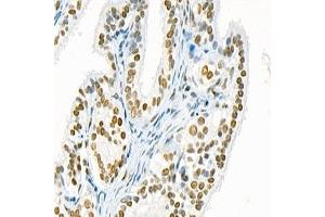Immunohistochemistry analysis of paraffin-embedded rat ovary using,Mettl11a (ABIN7074612) at dilution of 1: 1500 (METTL11A anticorps)