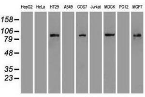 Image no. 1 for anti-Catenin (Cadherin-Associated Protein), beta 1, 88kDa (CTNNB1) (AA 531-781) antibody (ABIN1496902)