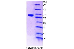 SDS-PAGE analysis of Rat PTPN14 Protein. (PTPN14 Protéine)
