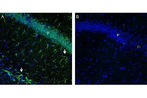 Expression of GPR43/FFAR2 in mouse hippocampus. (FFAR2 anticorps  (C-Term, Intracellular))