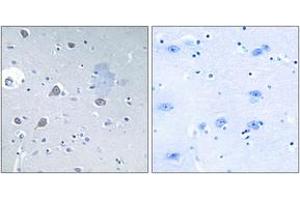 Immunohistochemistry analysis of paraffin-embedded human brain tissue, using p70 S6 Kinase (Ab-371) Antibody.
