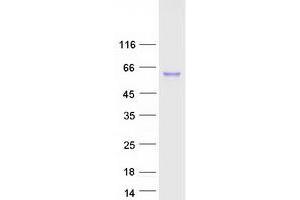 Validation with Western Blot