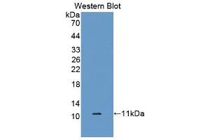Western blot analysis of the recombinant protein. (S100A6 anticorps  (AA 1-90))