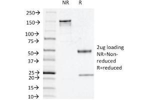 SDS-PAGE Analysis Purified Thymidine Phosphorylase / PD-ECGF Mouse Monoclonal Antibody (P-GF.