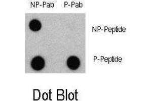 Dot blot analysis of Phospho-LC3 (APG8a) - Ser12 Antibody and Non phospho-LC3 (APG8a) Antibody on nitrocellulose membrane. (MAP1LC3A anticorps  (N-Term, pSer12))