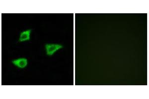 Immunofluorescence analysis of LOVO cells, using CHRM4 antibody. (CHRM4 anticorps  (Internal Region))