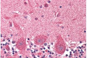 Human Brain, Cerebellum (formalin-fixed, paraffin-embedded) stained with DCTN1 antibody ABIN337005 at 2. (Dynactin 1 anticorps  (AA 1266-1278))