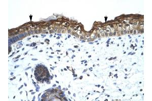 SMARCA2 antibody was used for immunohistochemistry at a concentration of 4-8 ug/ml to stain Squamous epithelial cells (arrows) in Human Skin. (SMARCA2 anticorps  (Middle Region))