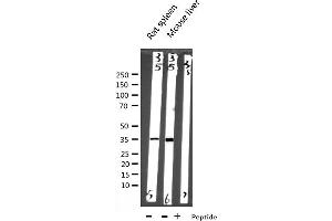 Western blot analysis of EFNB2 expression in various lysates (Ephrin B2 anticorps  (C-Term))