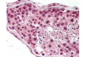 Human Testis: Formalin-Fixed, Paraffin-Embedded (FFPE). (BRPF3 anticorps  (AA 801-850))