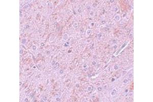 Immunohistochemical staining of rat brain tissue with PIAS2 polyclonal antibody  at 5 ug/mL dilution. (PIAS2 anticorps  (N-Term))
