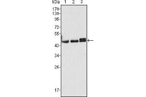 Western blot analysis using CK17 mouse mAb against Hela (1), MCF-7 (2) and A431 (3) cell lysate. (KRT17 anticorps)