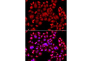 Immunofluorescence analysis of  cells using PIP4K2B antibody (ABIN6130646, ABIN6145675, ABIN6145677 and ABIN6216199). (PIP4K2B anticorps  (AA 1-270))