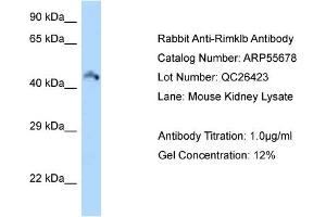 Western Blotting (WB) image for anti-Ribosomal Modification Protein RimK-Like Family Member B (RIMKLB) (Middle Region) antibody (ABIN2786316) (RIMKLB anticorps  (Middle Region))