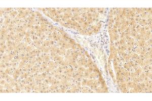 Detection of IL1a in Human Liver Tissue using Polyclonal Antibody to Interleukin 1 Alpha (IL1a)