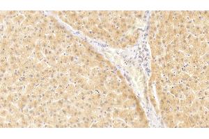 Detection of IL1a in Human Liver Tissue using Polyclonal Antibody to Interleukin 1 Alpha (IL1a) (IL1A anticorps  (AA 113-271))
