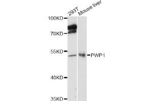 Western blot analysis of extracts of various cell lines, using PWP1 antibody (ABIN6293029) at 1:3000 dilution. (PWP1 anticorps)