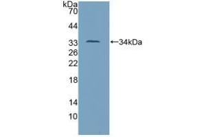 Detection of Recombinant TP53, Mouse using Polyclonal Antibody to Tumor Protein p53 (P53)