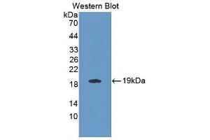 Western Blotting (WB) image for anti-Interleukin 25 (IL25) (AA 33-169) antibody (ABIN1868646) (IL-25 anticorps  (AA 33-169))