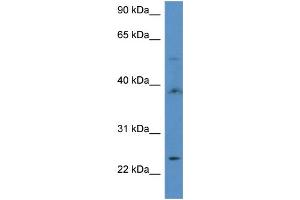 WB Suggested Anti-ACOT9 Antibody Titration: 1. (ACOT9 anticorps  (C-Term))