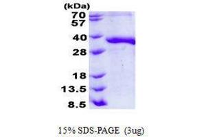 Figure annotation denotes ug of protein loaded and % gel used. (JAM2 Protéine)