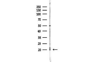 Western blot analysis of lysates from PC12 cells(LPS 4h treatment), using NPC2 Antibody at 1/1000 dilution.
