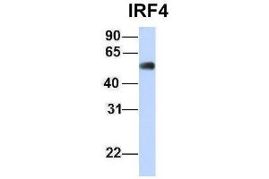 Host:  Rabbit  Target Name:  IRF4  Sample Type:  Human Fetal Muscle  Antibody Dilution:  1. (IRF4 anticorps  (Middle Region))