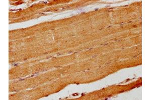 IHC image of ABIN7157686 diluted at 1:200 and staining in paraffin-embedded human skeletal muscle tissue performed on a Leica BondTM system. (ANKRD15 anticorps  (AA 66-255))