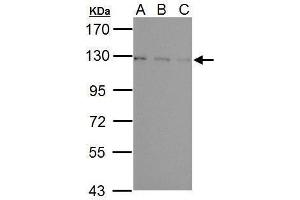 WB Image Sample (30 ug of whole cell lysate) A: NIH-3T3 B: JC C: BCL-1 7. (USP15 anticorps  (C-Term))