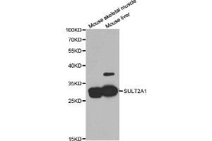 Western Blotting (WB) image for anti-Sulfotransferase Family, Cytosolic, 2A, Dehydroepiandrosterone (DHEA)-Preferring, Member 1 (SULT2A1) antibody (ABIN1876677) (SULT2A1 anticorps)