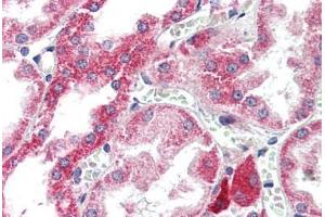 Human Kidney (formalin-fixed, paraffin-embedded) stained with ATG7 antibody ABIN307175 at 5 ug/ml followed by biotinylated goat anti-rabbit IgG secondary antibody ABIN481713, alkaline phosphatase-streptavidin and chromogen. (ATG7 anticorps  (C-Term))