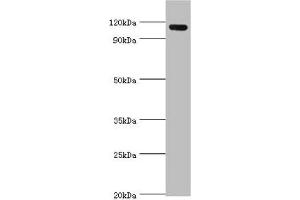 Western blot All lanes: Angiomotin antibody at 2 μg/mL + 293T whole cell lysate Secondary Goat polyclonal to rabbit IgG at 1/10000 dilution Predicted band size: 119, 73 kDa Observed band size: 119 kDa (Angiomotin anticorps  (AA 1-300))