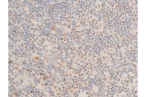 ABIN6267073 at 1/100 staining human appendiceal tissue sections by IHC-P.